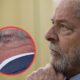 presidente-lula-cirurgia